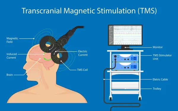 A person holding their head in distress, symbolizing the potential emotional toll of TMS therapy.