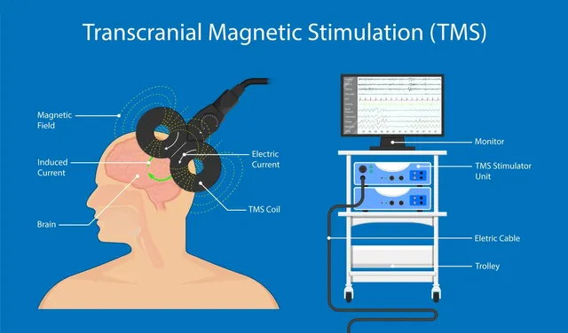 A person holding their head in distress, symbolizing the potential emotional toll of TMS therapy.